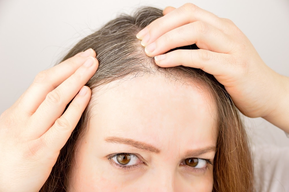 What Causes White Hair at Early Age? (And How to Avoid It) What Causes White Hair at Early Age? (And How to Avoid It)