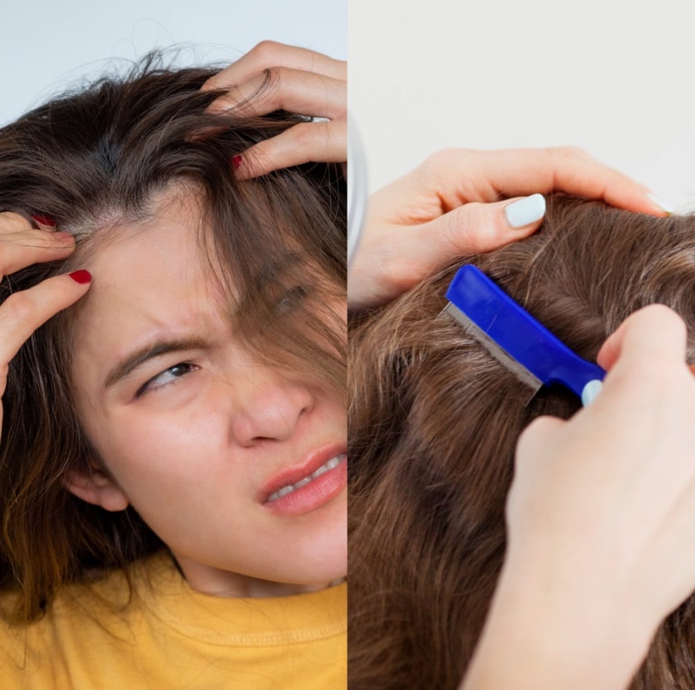 reasons why scalp hurt when combed or pressed